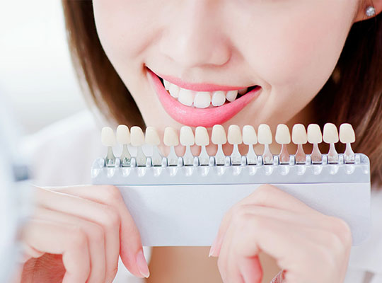 トータルホワイトニング