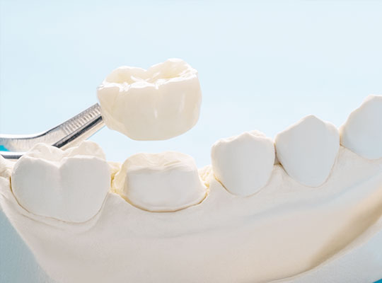 ホワイトクラウン