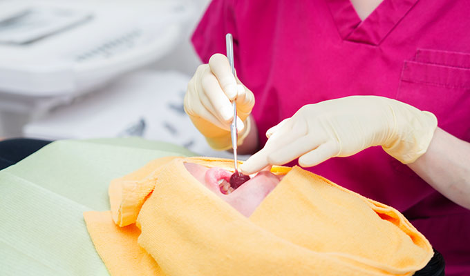 口の状態チェック